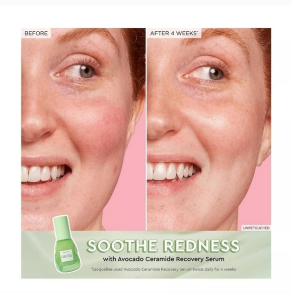 Gloe Recipe Glow Babies Set - Picture 6 of 7